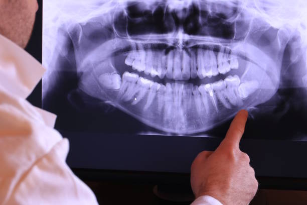 Best Weekend Emergency Dentist in Burlington, NC